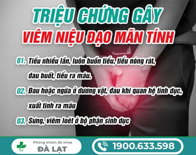 Hình ảnh minh họa